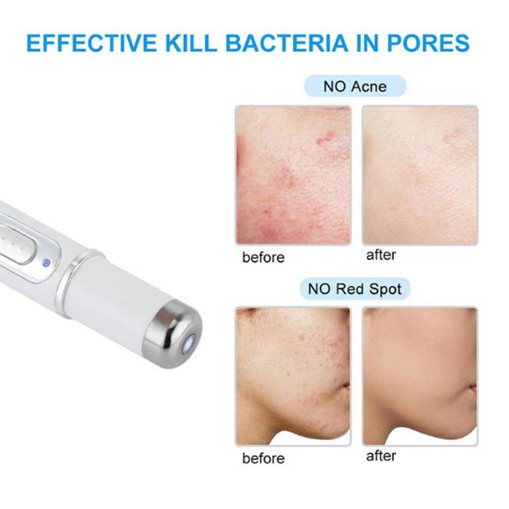 Lápiz para acné tratamiento blue light de 415 nm