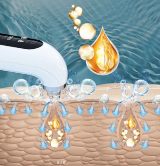 Hydrafacial Portátil Profesional – Recargable