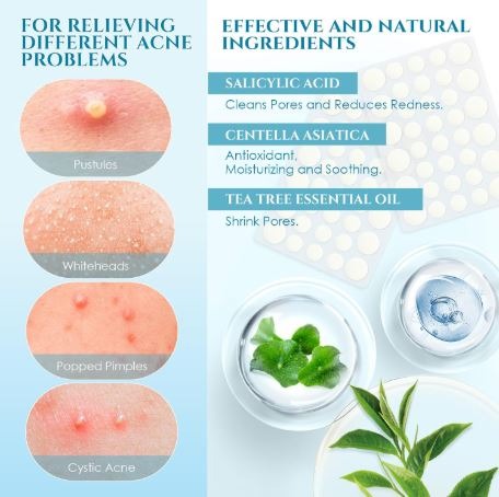 Parches Antiacné | Pack de 30 Unidades
