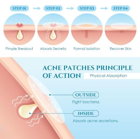 Parches Antiacné | Pack de 30 Unidades