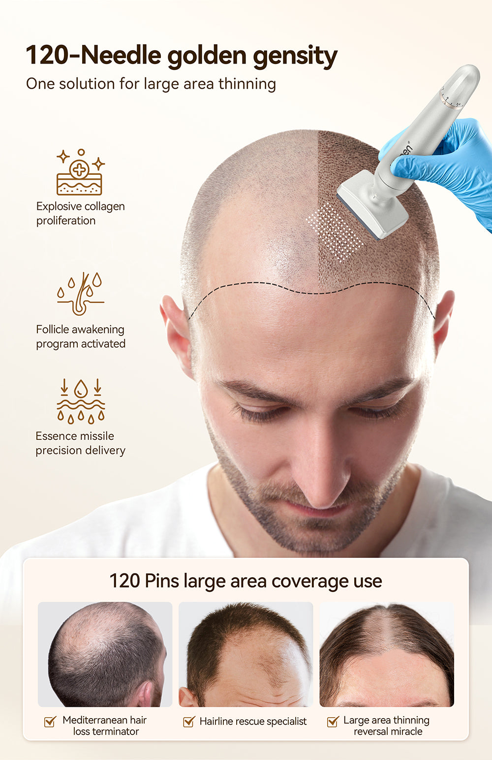 Biopen Microagujas Ajustable Biopen 4 Microneedling dermapen dermarroller