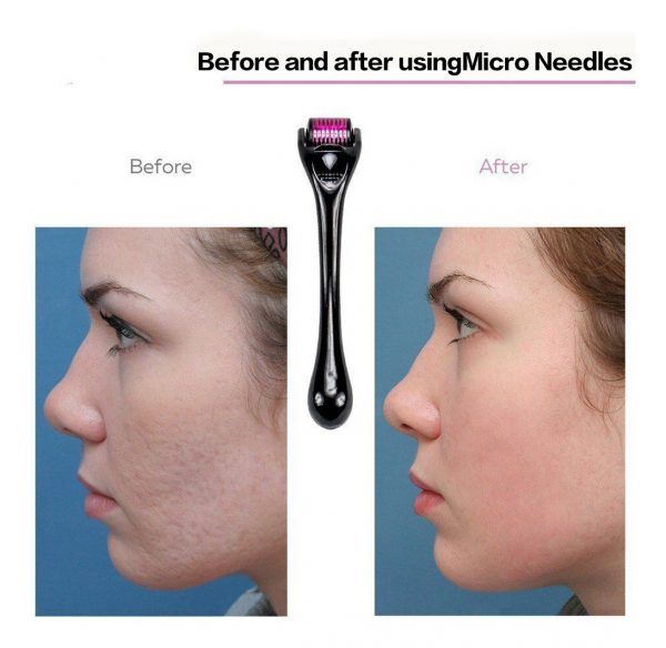 Derma Roller 0.5 mm – Inductor de Colágeno Percutáneo