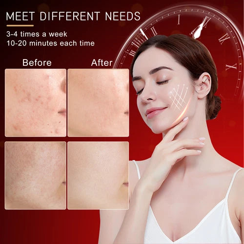 Máscara Facial Led Fototerapia 7 Colores Inalambrica